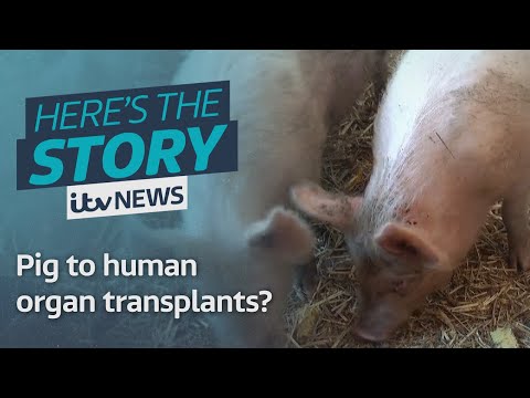 Could pig to human organ transplants be in our future?
