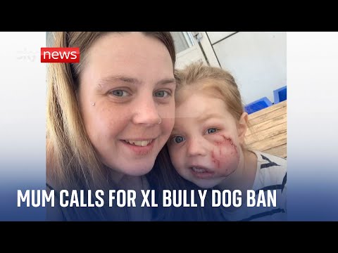 Mum tells how daughter was mauled by friend’s American XL bully dog