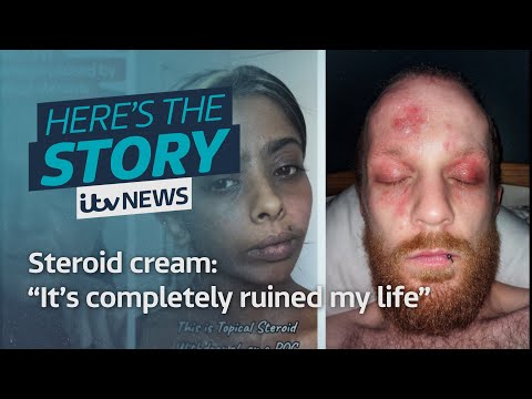Steroid cream: “It’s completely ruined my life | ITV News