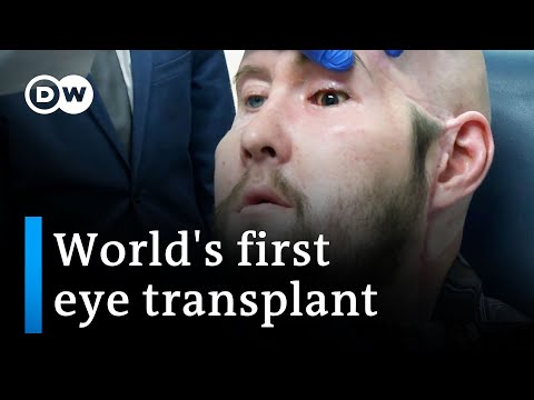 Surgeons perform world’s first human eye transplant | DW News