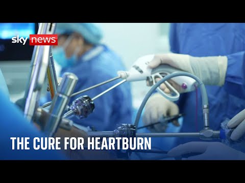 Heartburn: ‘Revolutionary’ surgical procedure cures condition with a device