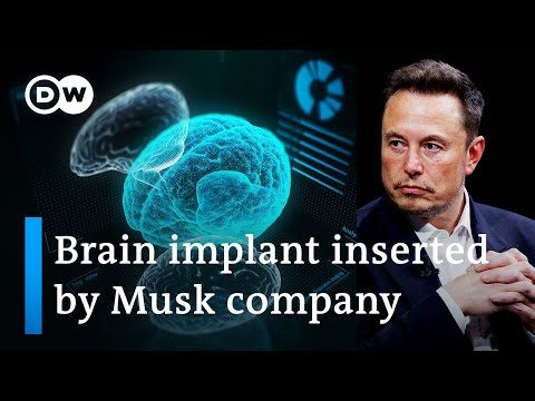 Elon Musk’s start-up Neuralink implants first chip in human brain | DW News