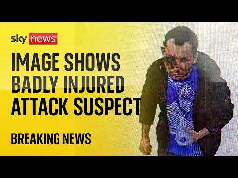 BREAKING: Police release image of injured Clapham chemical attack suspect