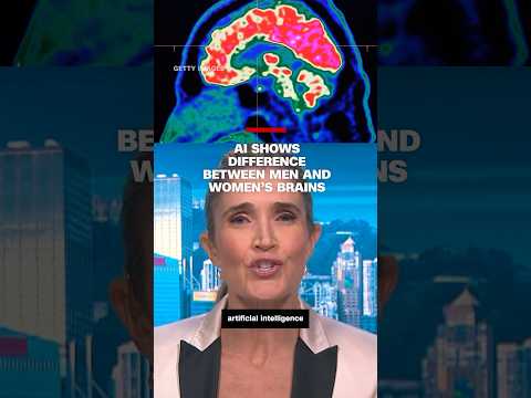 AI shows difference between men and women’s brain