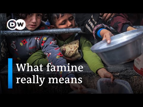 Gaza famine could hurt people’s health for decades | DW News