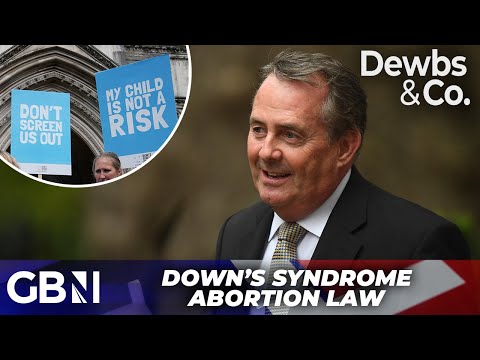Tory MP calls for amendment to Down’s syndrome abortion law banning terminations after 24 weeks
