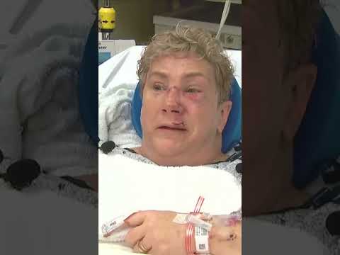 ‘I was gonna die’ says woman after black bear attack in Pennsylvania