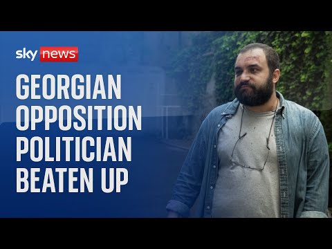 Georgian opposition politician says he was targeted by ‘Putin’s puppets’