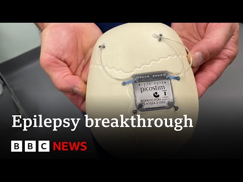 World’s first epilepsy device fitted in boy’s skull | BBC News