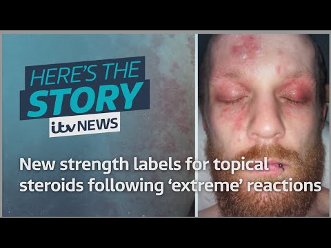 New strength labels for topical steroids following ‘extreme’ reactions | ITV News