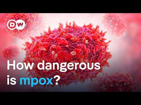 New mpox virus: Why is it spreading so quickly? | DW News