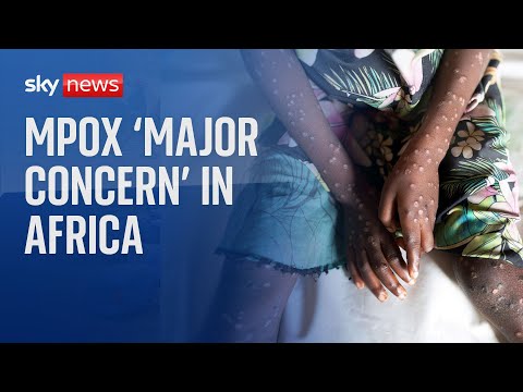 Mpox ‘major concern for Africa’ as WHO declares global health emergency
