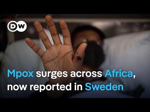 Mpox virus moves to Sweden as DRC remains most impacted | DW News