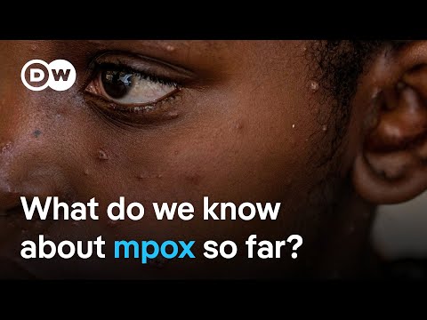 EU says further mpox cases are likely to be found soon in Europe | DW Analysis