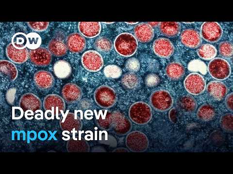 Children hit hardest by new outbreak of mpox in DRC | DW News