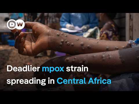 With deadlier mpox strain spreading in Central Africa, what’s holding up vaccinations ? | DW News