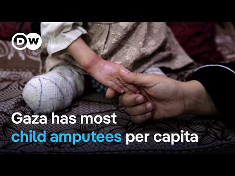 Doctors in Romania treat some of Gaza’s wounded | DW News