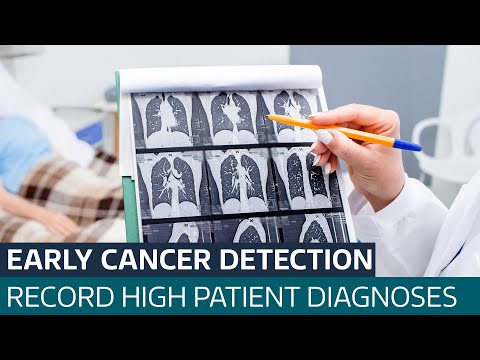 More cancer patients than ever in England are being diagnosed at early stage | ITV News