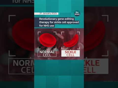 Revolutionary gene-editing therapy for sickle cell approved for use on NHS.