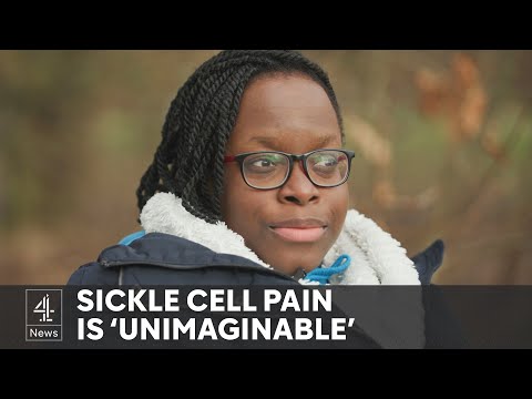 NHS approves groundbreaking sickle cell treatment