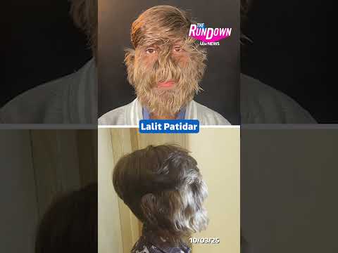An 18-year-old from India officially has the world’s hairiest face  #itvnews #hair #worldrecord