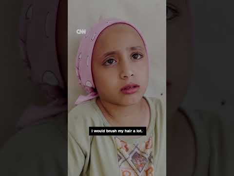 Doctors say war in Gaza led to child’s hair loss