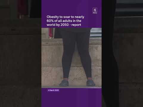 Obesity to soar around world by 2050