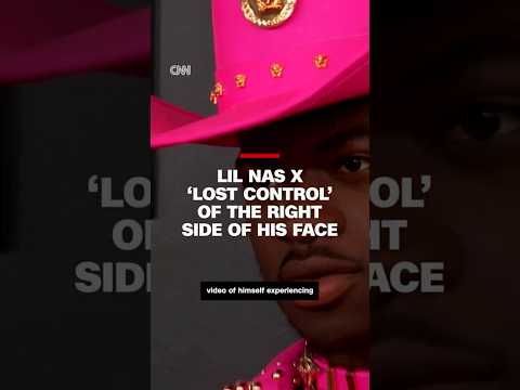 Lil Nas X ‘lost control’ of the right side of his face