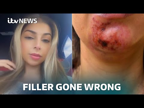 ‘I look like a monster’: Calls for government to act on non-surgical cosmetic procedures | ITV News