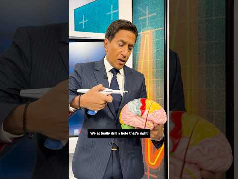 Dr. Sanjay Gupta demonstrates shunt procedure that might treat Billy Joel’s neurological disorder