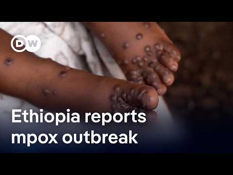 Ethiopia reports reports first mpox cases and death | DW News