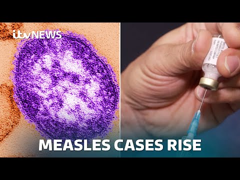 Measles infections on the rise globally with families warned as summer holidays approach | ITV News