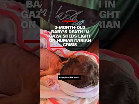 3-month-old baby’s death in Gaza sheds light on humanitarian crisis