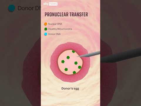 Babies born by three person IVF