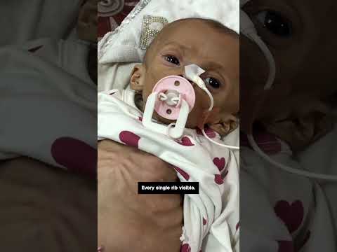 Surgeon shows humanitarian crisis in Gaza’s hospitals