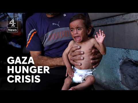 ‘A state of child famine’ – Gaza’s deepening hunger crisis