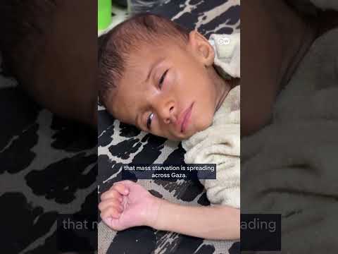 WHO: Palestinians in Gaza are suffering from “man-made” mass starvation | DW News