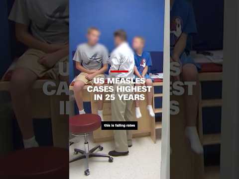 Dr. Gupta discusses US measles cases surpassing 25-year-high