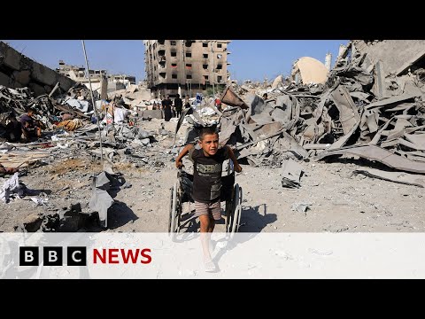 Children in Gaza ‘like zombies’ because of severe malnutrition, US doctor says | BBC News