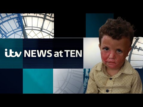 Watch ITV News at Ten as Gaza’s sick children talk not of illness, but hunger in Jordan | ITV News