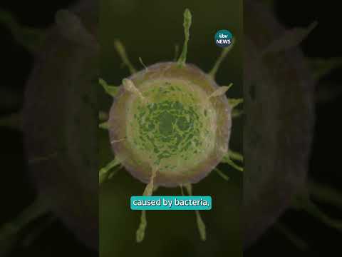 New antibiotic for UTIs approved for first time in three decades | ITV News