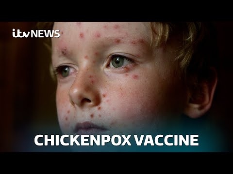Chickenpox vaccine to be rolled out on NHS | ITV News