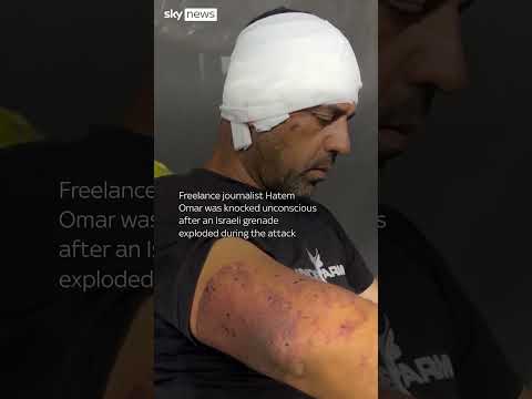 ‘When I woke up, everyone was dead except me’: Gazan journalist recalls strike on Nasser Hospital