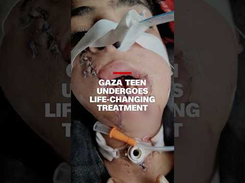 From the Morgue to the Operating Room: Majd’s Fight to Smile Again
