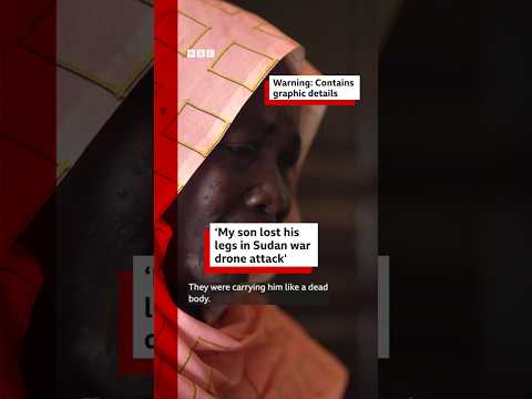 ‘My son lost his legs in a Sudan war drone attack’. #Sudan #Khartoum #BBCNews