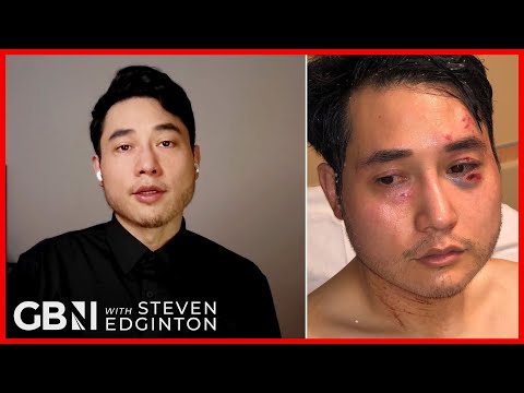 ‘I was nearly killed by the Far-Left’ Andy Ngo on Antifa