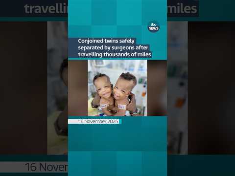 A pair of conjoined twins have been safely separated by surgeons #itvnews