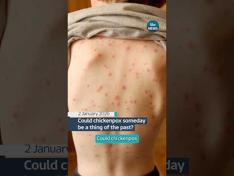 Could chickenpox someday be a thing of the past?