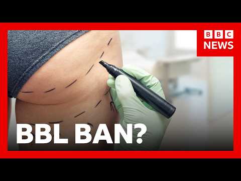 Tighter restrictions on Brazilian butt lift procedures needed, UK MPs warn | BBC News