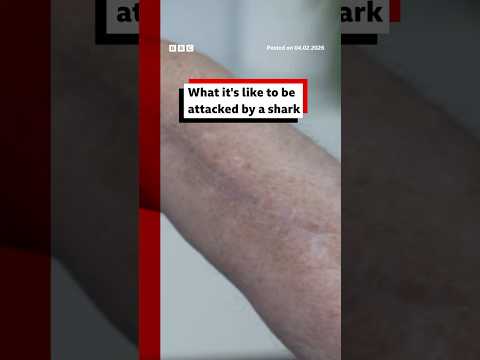 What it’s like to be attacked by a shark. #Sharks #SharkAttack #BBCNews